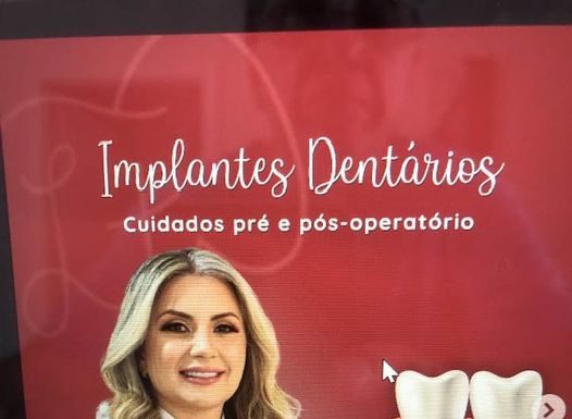 Saúde bucal: Sobre implante